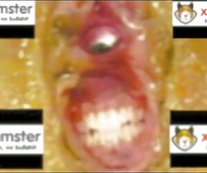 Dầu được đổ vào các lỗ của trực tràng để phim sexx nhanh bôi trơn kính.