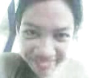 Sưng vết bầm sexx nung lon do vết nứt ở các điểm thứ năm của đường hẹp